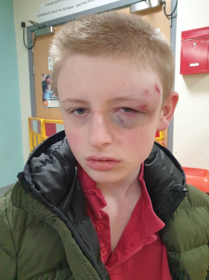 Main image for Teen is reeling from assault